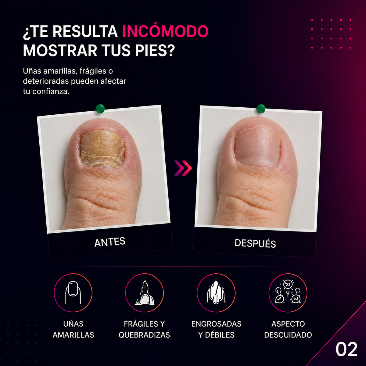 FungiCare™ | 60 Cápsulas eliminadora de hongos.